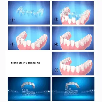 1PC Silikonski Ortodontskega Oklepaji Zobni Instanted Nasmeh Zob Poravnavo Trener Zob Honorar Usta Stražar Oklepaji Zob Pladenj